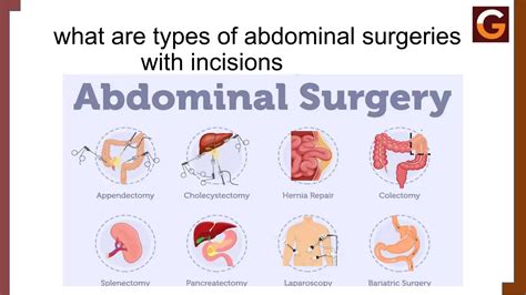 Diagram illustrating the areas targeted by common body contouring surgeries like abdominoplasty and arm lift.