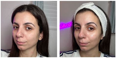 Before and after images showcasing the skin improvements from using snail mucin