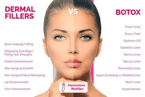 Comparison chart of Botox and Dermal Fillers