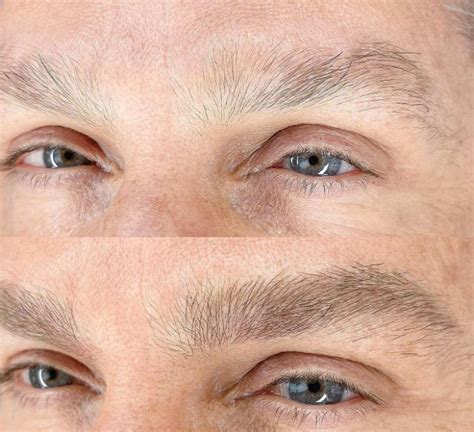 Infographic illustrating the benefits of microblading for men, such as enhanced confidence and a more youthful appearance.