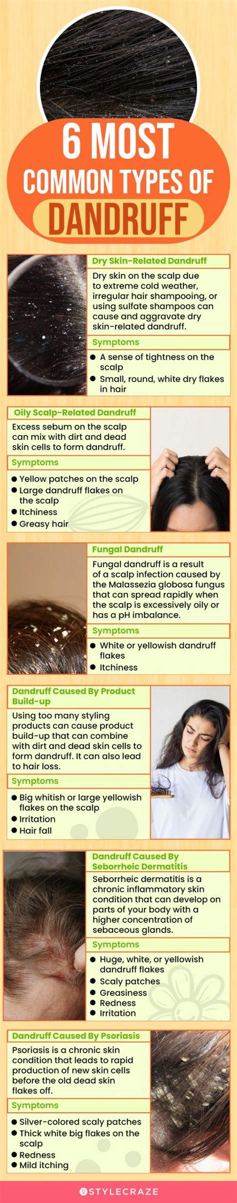 Infographic comparing different types of dandruff and their recommended treatments.