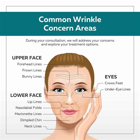 Infographic illustrating the décolletage area and common wrinkle causes.