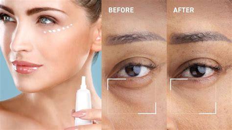 Selection of effective eye creams for dark circles