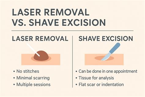 Diagram illustrating different mole removal techniques: shave excision, surgical excision, cryotherapy, and laser removal