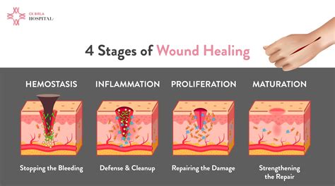 Diagram illustrating the stages of normal circumcision healing, including scab formation and the eventual detachment of a plastic ring if used.