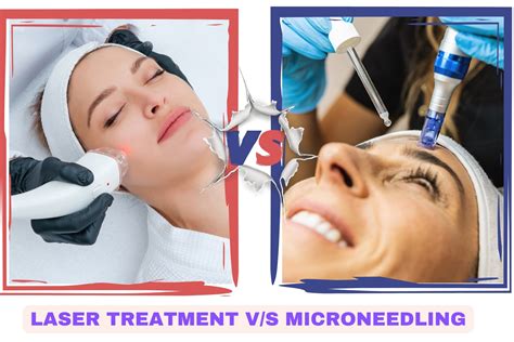 Collage of before-and-after photos for various chest wrinkle treatments (laser, injectables, microneedling).