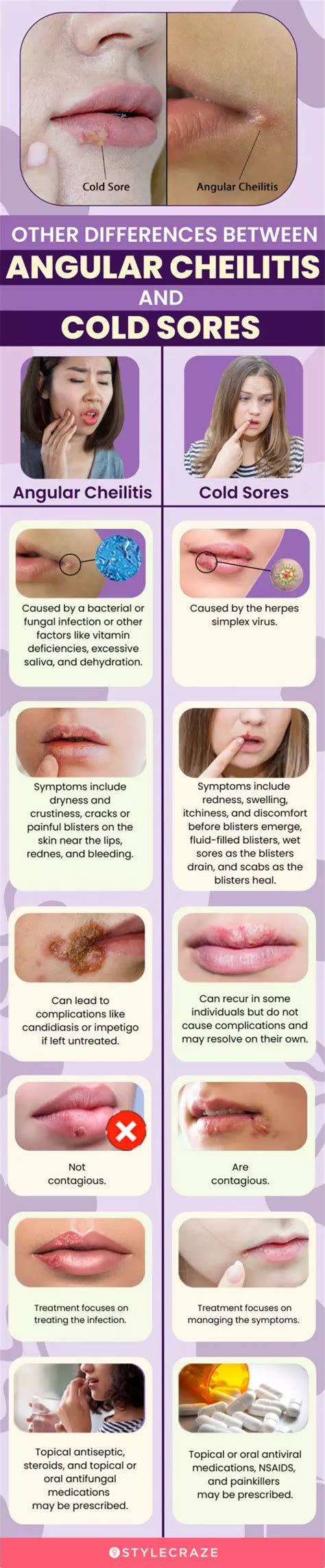 An infographic comparing the visual differences between angular cheilitis and cold sores.
