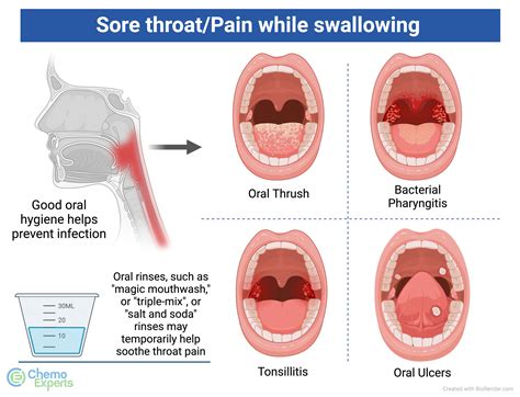 Illustration of steam rising from a hot shower, indicating its soothing effect on a sore throat.