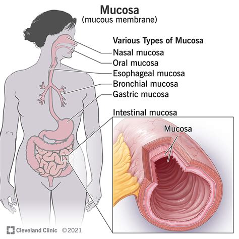 Diagram illustrating the locations of mucous membranes in the body where mucosal melanoma can develop.