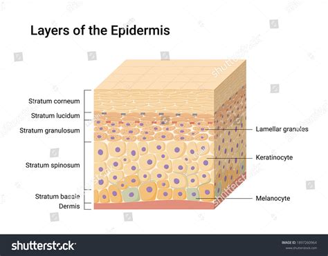 Diagram illustrating the layers of the skin (epidermis and dermis) and the migration of pigment cells.