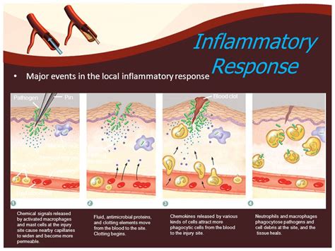 Illustration showing different types of inflammatory skin conditions that can lead to PIH.