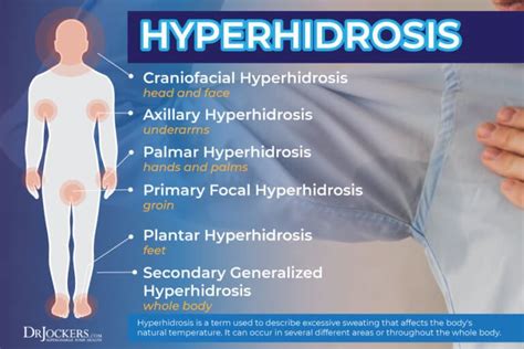 Infographic illustrating the difference between normal sweating and hyperhidrosis, highlighting affected body areas.