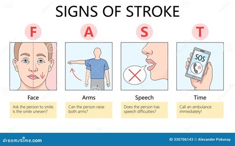 infographic illustrating FAST stroke symptoms: Face drooping, Arm weakness, Slurred speech, Time to call emergency services