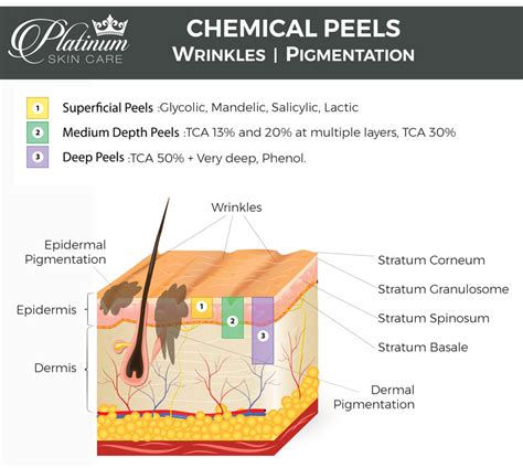Diagram illustrating the depth of superficial, medium, and deep chemical peels on the skin layers.