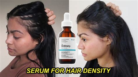 Infographic showing the percentage of users who reported specific benefits from using The Ordinary Multi-Peptide Serum for Hair Density.