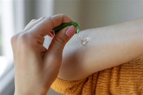 Image of a person applying aloe vera gel to a rash on their arm.