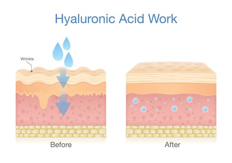 Diagram illustrating the step-by-step application of hyaluronic acid serum in a skincare routine