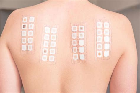 Illustration demonstrating how to perform a patch test on the skin