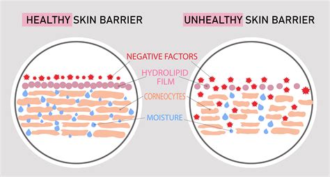 Infographic comparing healthy skin barrier function with compromised skin barrier due to inflammation.