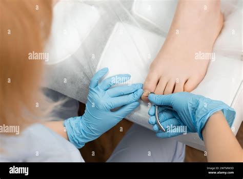 Close-up of a podiatrist examining a patient's toenail.