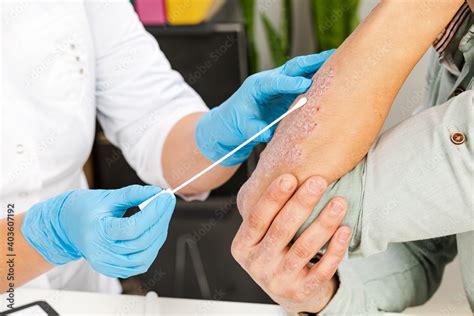 Dermatologist examining a patient's skin for rash diagnosis.
