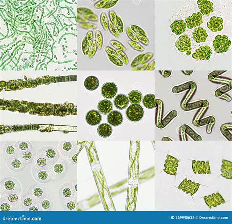 Microscopic view of different types of algae