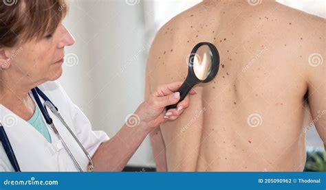 A dermatologist examining a patient's skin for dryness and irritation.
