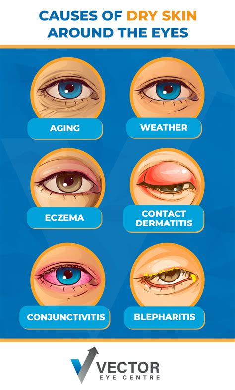 Illustration showing the delicate skin around the eye area and its susceptibility to sun damage
