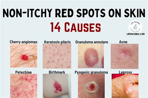 Illustrations of different presentations of drug allergy rashes: raised red patches, widespread irritated areas, and small, blister-like bumps.