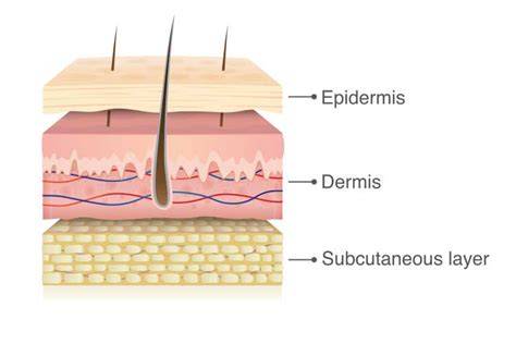 Illustration showing the layers of skin and how they separate in a partial and full-thickness skin tear.