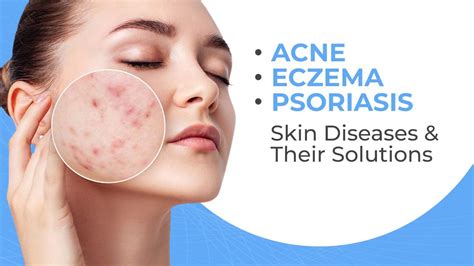 Infographic illustrating common skin conditions like acne, eczema, and psoriasis.