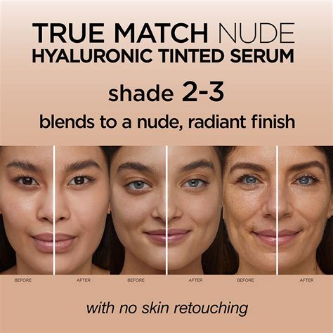 Before and after applying L'Oréal True Match Nude Hyaluronic Tinted Serum, showcasing coverage of redness and irritation.