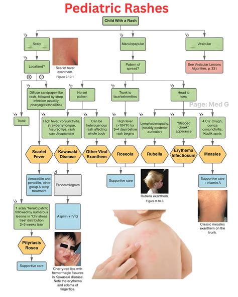 Diagram illustrating common locations and appearances of pediatric rashes