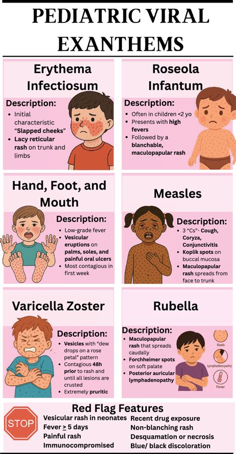 Infographic comparing the visual characteristics of common viral exanthems