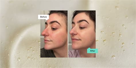 Split image showing a comparison of skin texture before and after applying hyaluronic acid, highlighting plumping and smoothing effects.