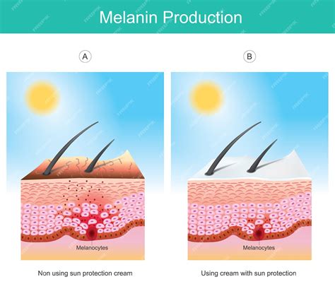 illustration showing melanin production in skin cells after inflammation