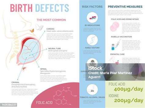 illustration of common birth defects associated with retinoid exposure