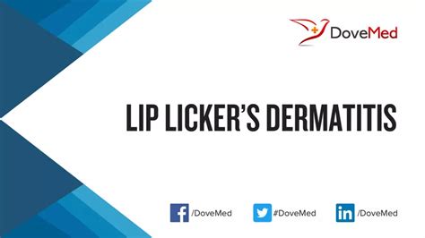 Side-by-side comparison chart of symptoms for lip licker's dermatitis and common differential diagnoses.