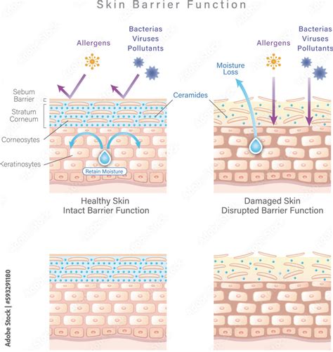 Diagram showing how Niacinamide strengthens the skin barrier and its anti-inflammatory effects.