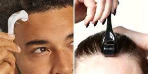 Visual guide demonstrating the four directions of dermarolling on a section of the scalp.