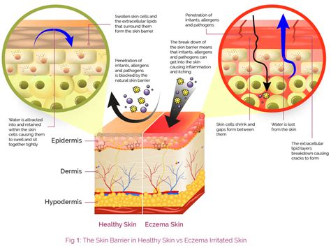 Diagram showing the structure of the skin barrier and the role of ceramides in maintaining its integrity.