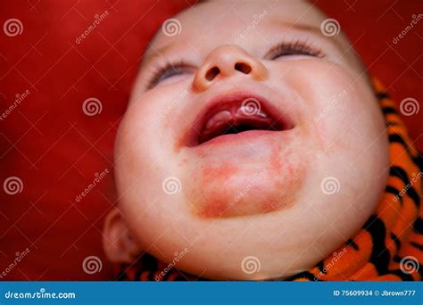 infant with drool around mouth