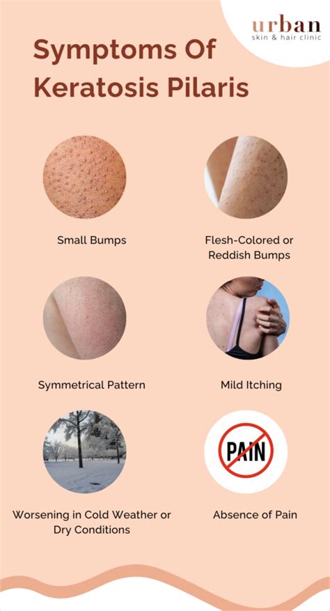 Infographic comparing common causes of bumpy skin: Keratosis Pilaris (keratin buildup), Acne (clogged pores), Contact Dermatitis (allergic reaction).