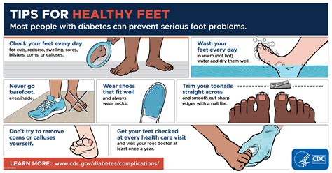 Visual guide to proper foot hygiene and shoe care for preventing fungal infections.