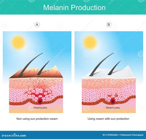 A diagram illustrating the cellular structure of the skin and how melanin production can be affected by various factors.