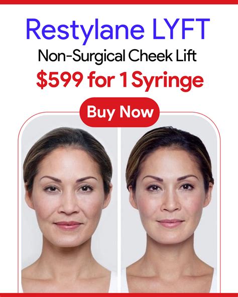 Collage of Restylane Lyft before and after photos showcasing facial rejuvenation and hand volume enhancement.