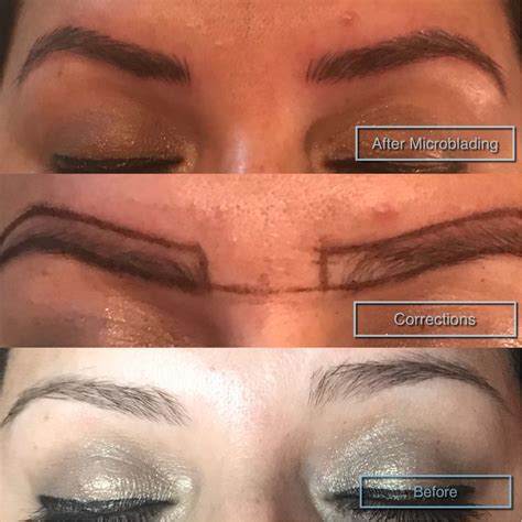illustration of a person's face showing uneven eyebrows before and after microblading correction