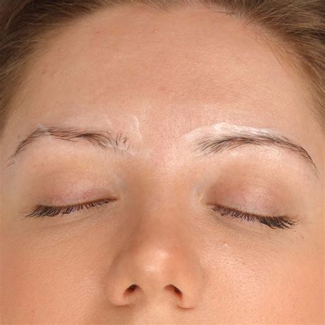 Image showing a person applying numbing cream to their eyebrow area before a procedure.