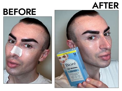 Before and after images of using Bioré Original Blackhead Remover Strips.