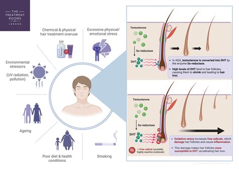 Infographic illustrating the process of scalp inflammation and its impact on hair follicles.